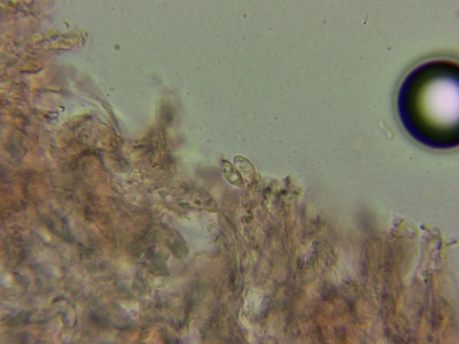 Microscopía de Marasmius rotula - 10 - Esporas en basidio